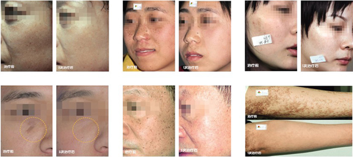 紲涙枒緹庡浠櫒