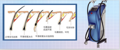 廣州脫毛儀器價(jià)格，脫毛一次多少錢(qián)，用什么儀器比較好？