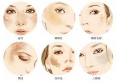 超皮秒有什么作用？新款的超皮秒廠家介紹