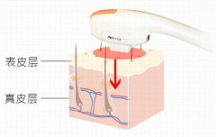 ?牛奶光機(jī)器多少錢一臺(tái)？?牛奶光價(jià)格報(bào)價(jià)_?牛奶光設(shè)備多少錢
