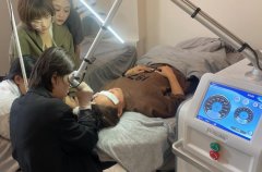 目前祛斑最好的儀器是哪一款？皮秒祛斑儀器多少錢(qián)一臺(tái)