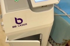 BB laser素顏光國內哪個生產(chǎn)廠家比較好？進口素顏光設備代理商