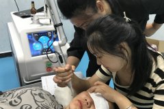 皮秒洗紋身機器哪家好？洗紋身最好的設備是哪種？皮秒洗紋身儀器